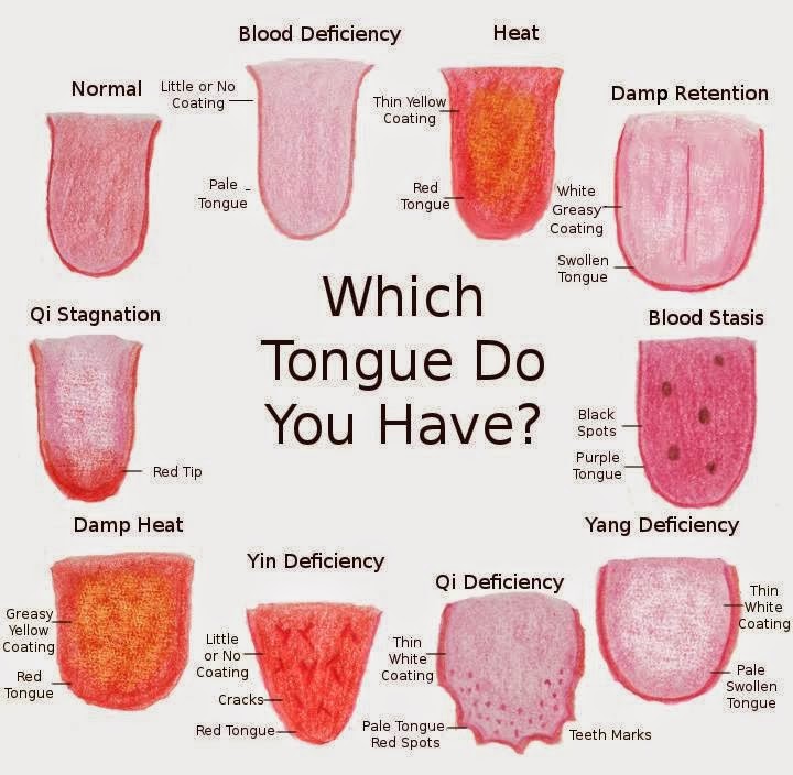Tongue2bdisease2bchart.jpg