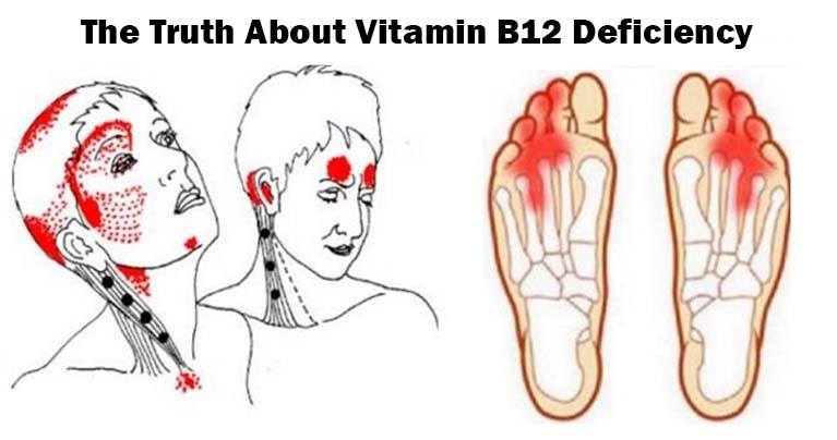 Give Me 10 Minutes Ill Give You The Truth About Vitamin B12 Deficiency.jpg