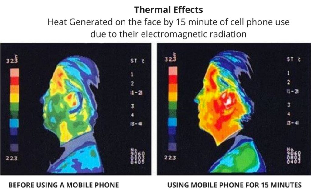 Thermal Effects Mobile Phone Radiation Kyutec Radiation Blocker.png