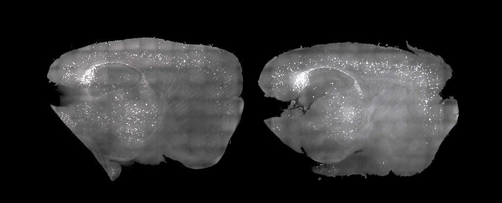 Mouse Brains Alzh Light Sound2b25e2258025942bmouse2bbrain2bwith2band2bwithout2btreatment2b2528gabrielle2bdrummond2529.jpg