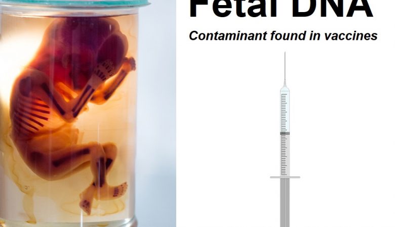 Unborn Fetus In Formalin Solution, Medical Research